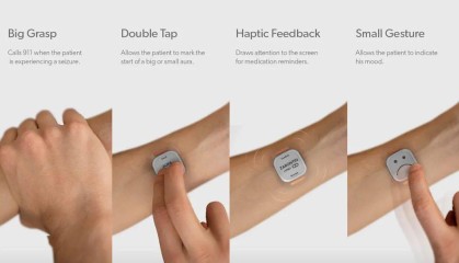  網球員护腕设计革新，智能监测设备预防运动损伤  